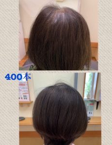 ビフォーアフター