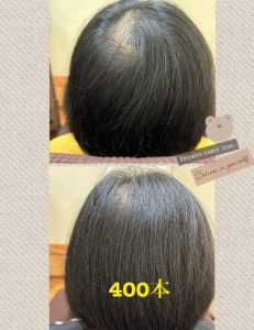 ビフォーアフター