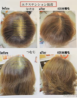 ビフォーアフター