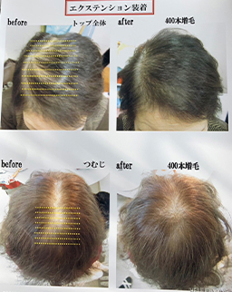 ビフォーアフター