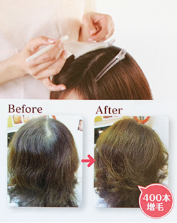 ビフォーアフター