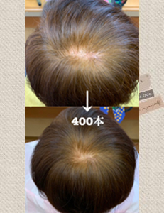 ビフォーアフター