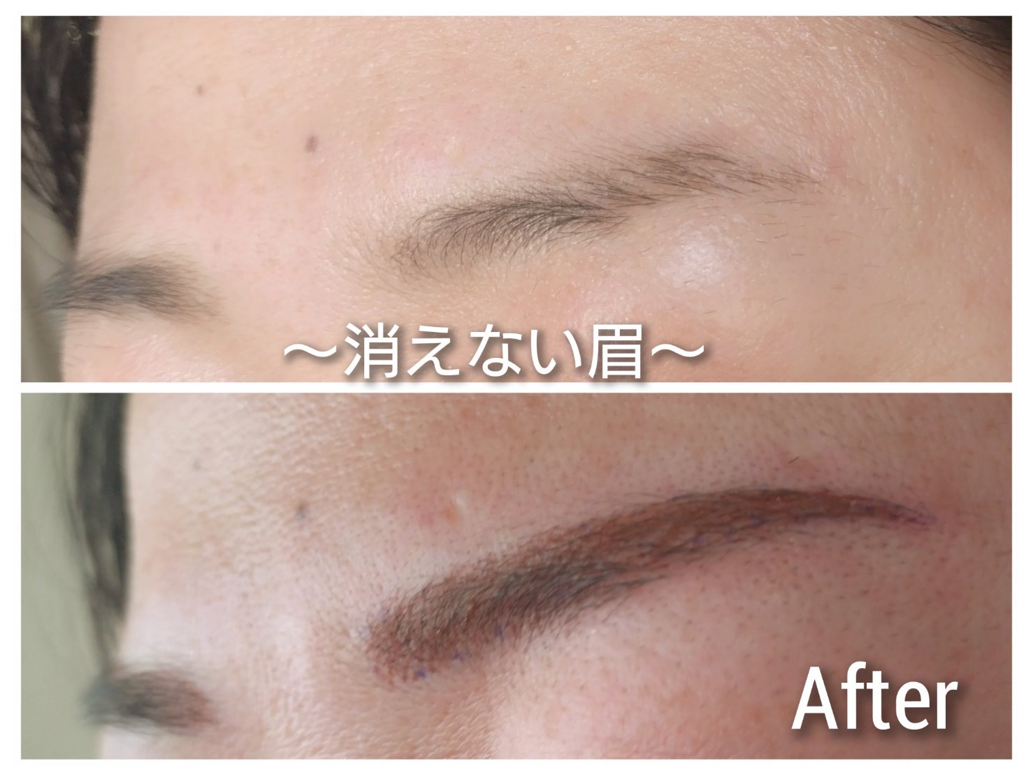 ビフォーアフター