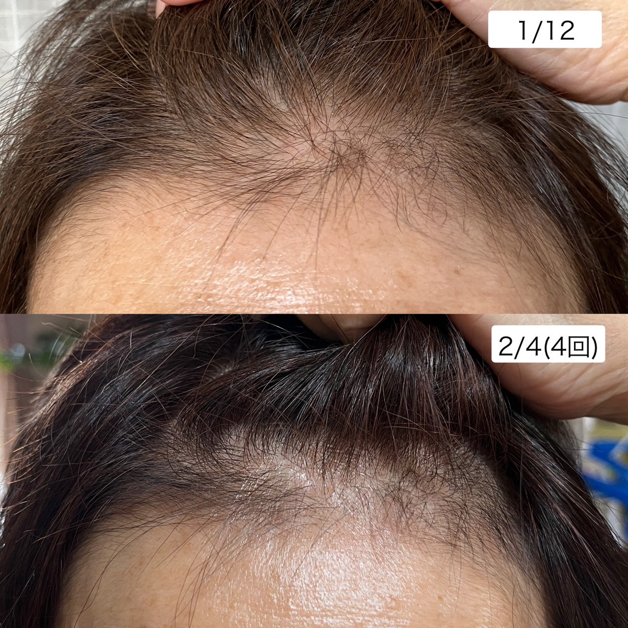 ビフォーアフター