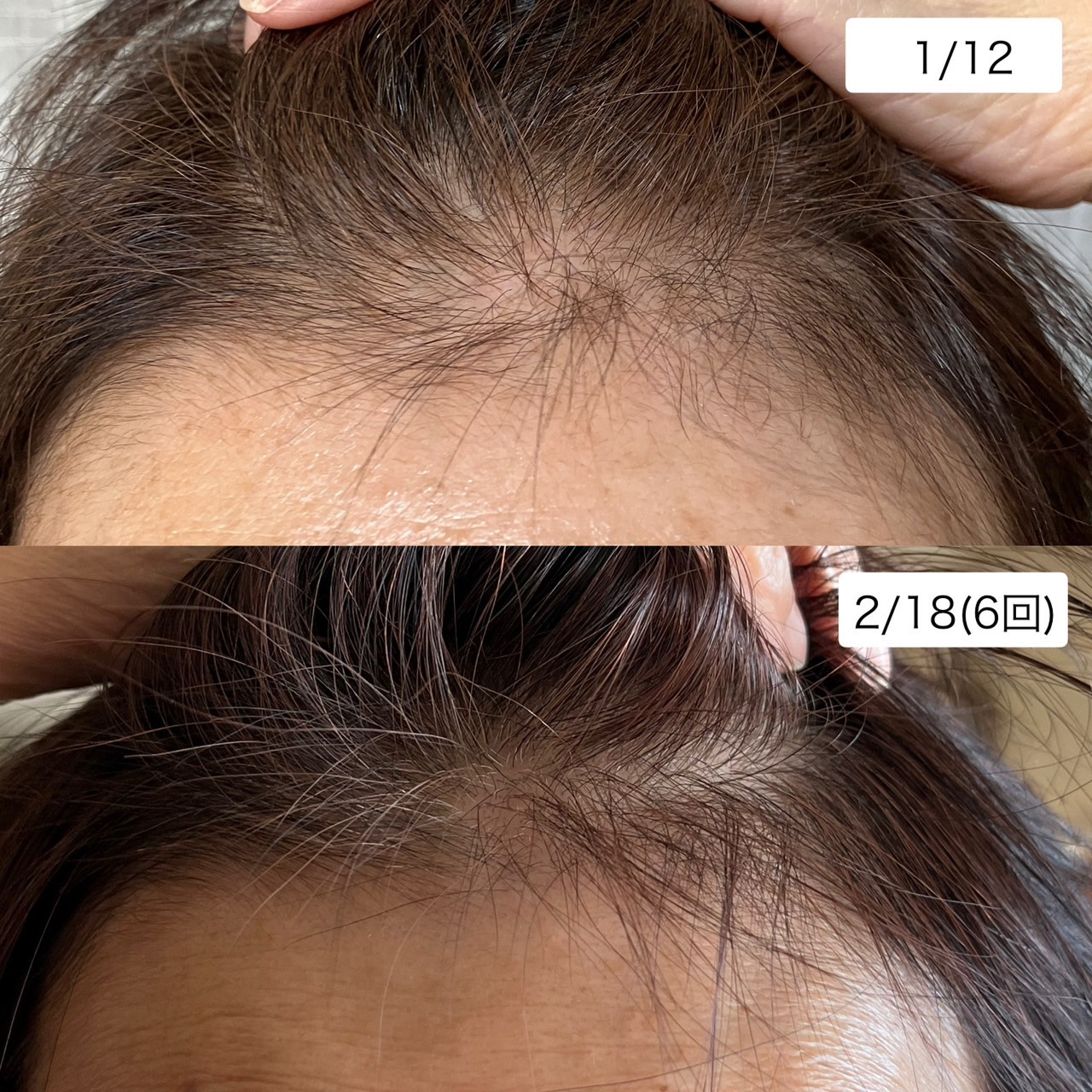 ビフォーアフター