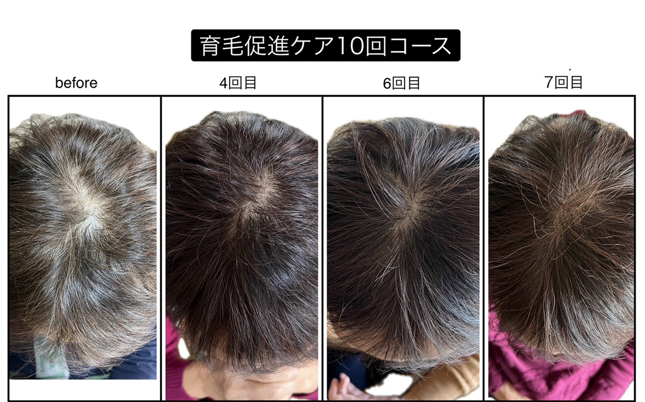 ビフォーアフター