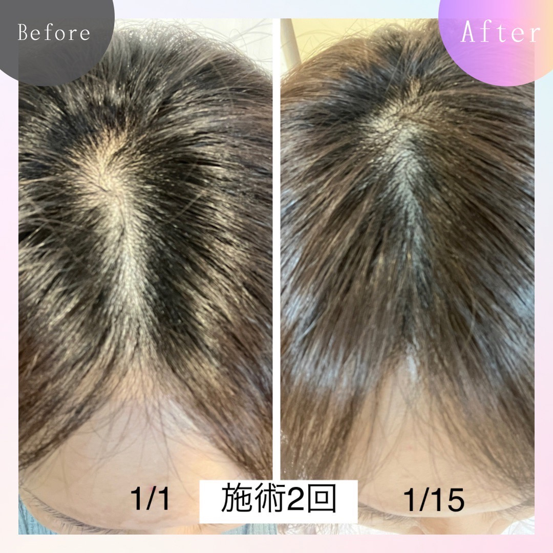 ビフォーアフター